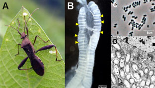 腸内微生物叢の群集構造と機能解析