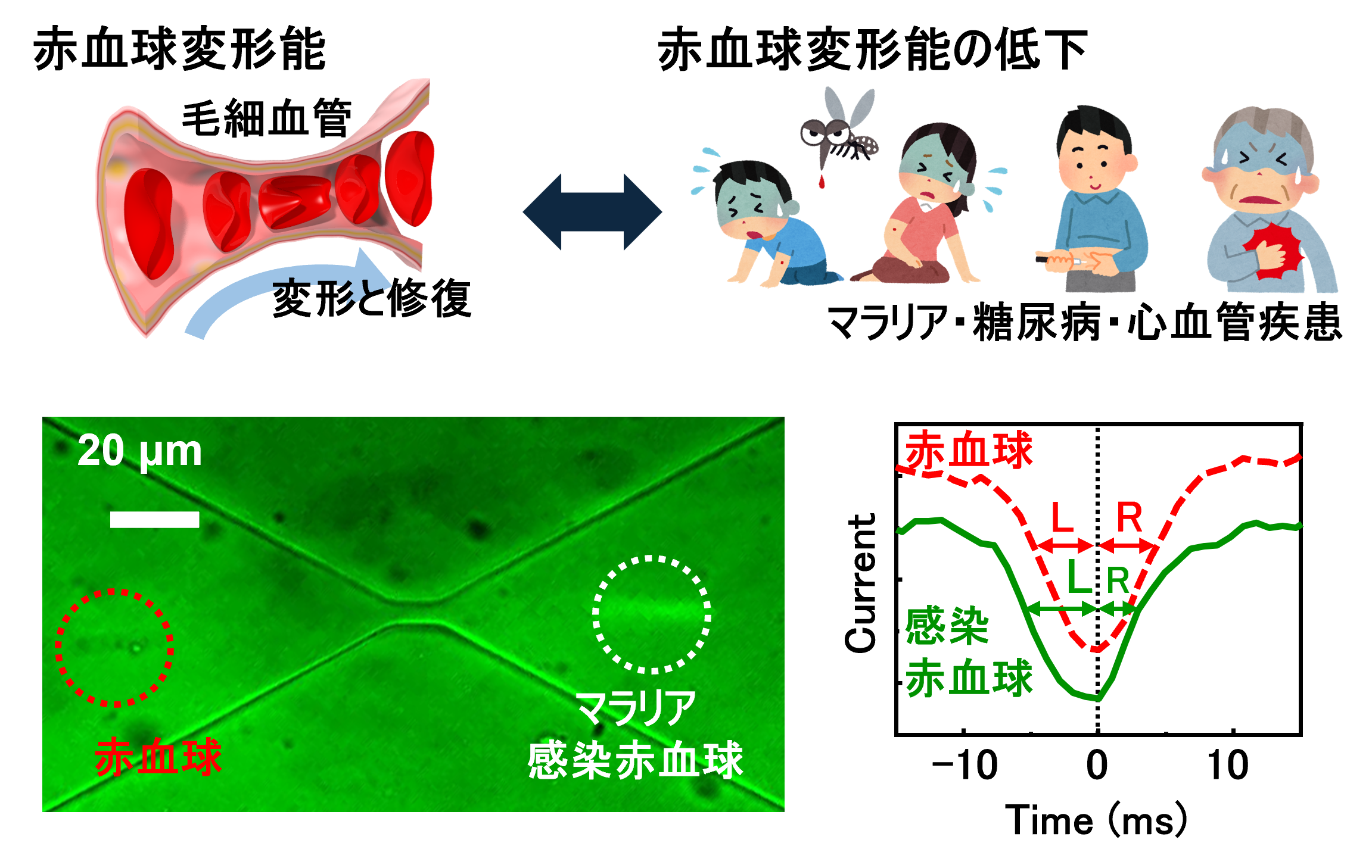 赤血球変形能をはじめとする細胞物性評価の図