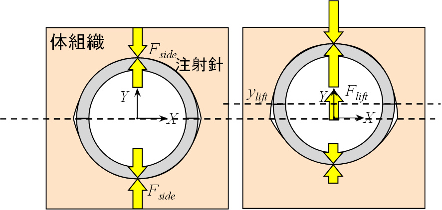針穿刺バイオメカニクスの図