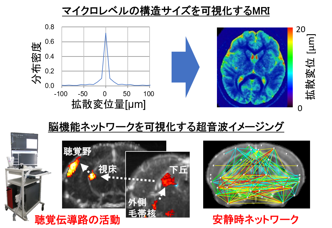 研究紹介図