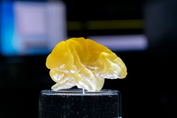 photo:3D-printed model of brain