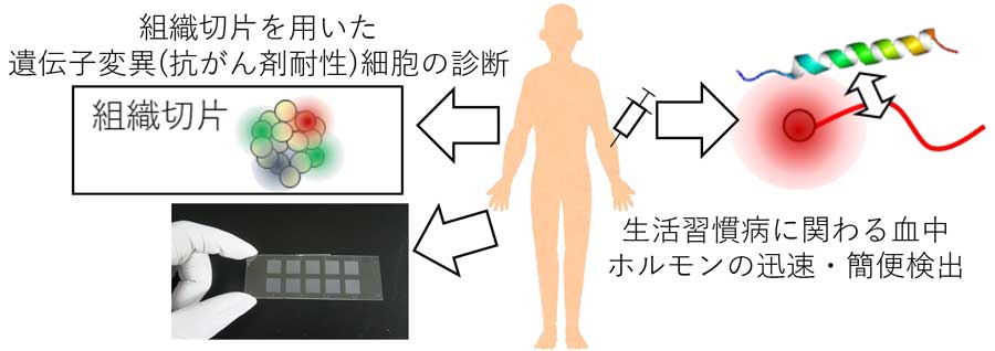 生活習慣病