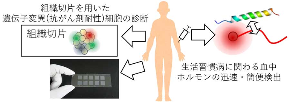 生活習慣病