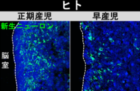 ヒトの剖検脳の解析。