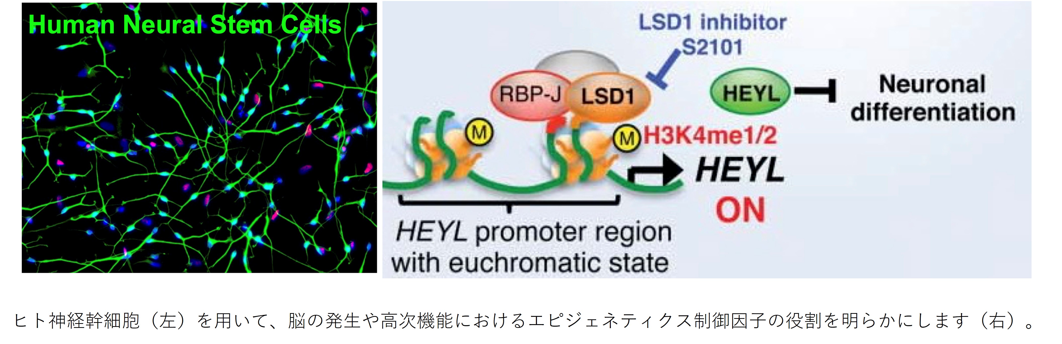 脳神経系におけるエピジェネティクス制御因子の機能解析とその創薬への応用